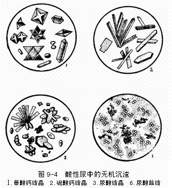 尿酸盐.png