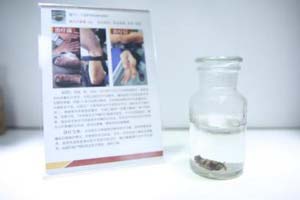 瓦工酗酒致痛风卧床不起，被迫放弃工作.jpg