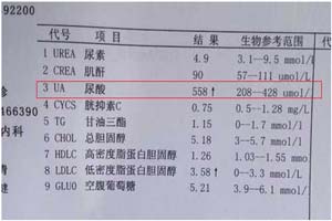 患者入院体检单显示尿酸值偏高.jpg